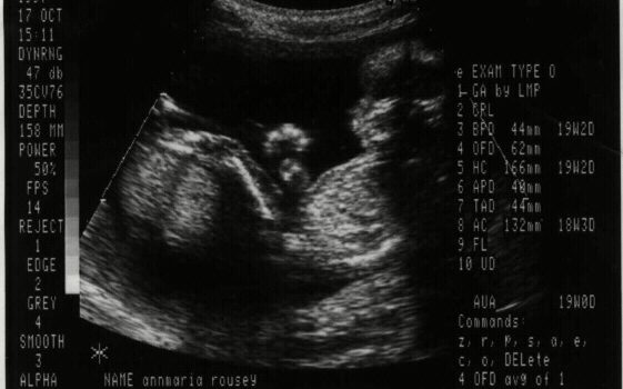 sonogram of Julia